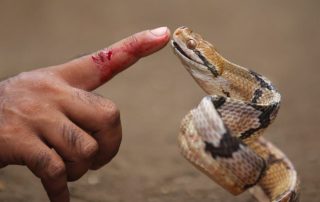 Survival in Russell's Viper Bite