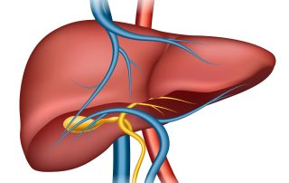 fatty liver disease